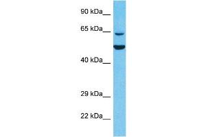 Host:  Rabbit  Target Name:  KLHL6  Sample Type:  293T Whole Cell lysates  Antibody Dilution:  1ug/ml (KLHL6 antibody  (N-Term))