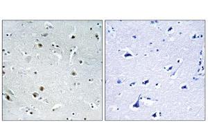 Immunohistochemistry analysis of paraffin-embedded human brain tissue using DDX24 antibody. (DDX24 antibody  (N-Term))
