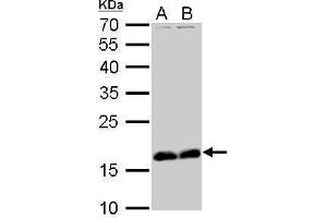 WB Image Stathmin 1 antibody detects STMN1 protein by Western blot analysis.