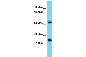 Host: Rabbit Target Name: Stra8 Sample Type: Mouse Liver lysates Antibody Dilution: 1.