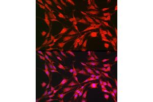 Immunofluorescence analysis of C6 cells using p70 S6 Kinase 1 Rabbit pAb (ABIN7270029) at dilution of 1:100 (40x lens). (RPS6KB1 antibody  (AA 361-525))