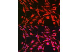 Immunofluorescence analysis of C6 cells using p70 S6 Kinase 1 Rabbit pAb (ABIN7270029) at dilution of 1:100 (40x lens). (RPS6KB1 antibody  (AA 361-525))