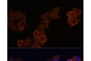 Immunofluorescence analysis of HeLa cells using DCN Polyclonal Antibody at dilution of 1:100 (40x lens). (Decorin antibody)