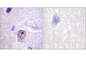 Immunohistochemistry analysis of paraffin-embedded human brain tissue, using SF1 (Ab-82) Antibody. (Splicing Factor 1 antibody  (AA 48-97))