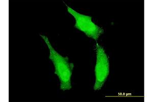 Immunofluorescence of monoclonal antibody to DND1 on HeLa cell. (DND1 antibody  (AA 167-260))