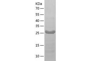 OTU Domain, Ubiquitin Aldehyde Binding 1 (OTUB1) (AA 1-271) protein (His-IF2DI Tag)