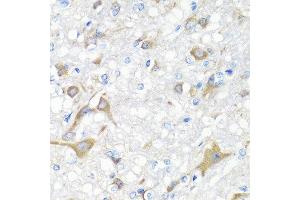 Immunohistochemistry of paraffin-embedded rat brain using IL22 antibody at dilution of 1:100 (40x lens). (IL-22 antibody)