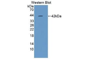 Detection of Recombinant NLRP3, Mouse using Polyclonal Antibody to NLR Family, Pyrin Domain Containing Protein 3 (NLRP3) (NLRP3 antibody  (AA 671-1033))