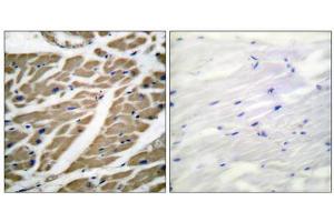 Immunohistochemical analysis of paraffin-embedded human heart tissue using Sodium Channel-pan antibody (ABIN5976507). (Sodium Channel antibody  (Internal Region, pan))