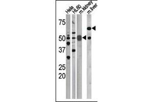 The anti-Phospho-CDC25A-S75 Pab (ABIN389531 and ABIN2839579) is used in Western blot to detect Phospho-CDC25A-S75 in, form left to right, Hela, HL60, mouse kidney, and mouse liver tissue lysates. (CDC25A antibody  (pSer75))
