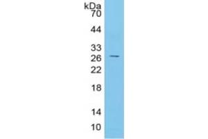 Western Blotting (WB) image for C-Reactive Protein (CRP) ELISA Kit (ABIN6574109)