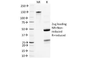 SDS-PAGE Analysis Purified Neurofilament Mouse Monoclonal Antibody (NR-4). (NEFL antibody)