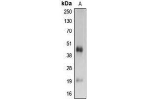 Western blot analysis of Caspase 4 p20 expression in Ramos (A) whole cell lysates. (Caspase 4 p20 (Center) antibody)