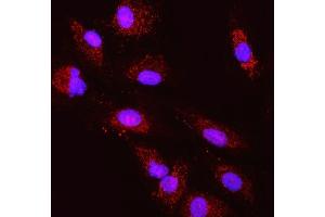 IF analysis of TST using anti-TST antibody (ABIN7599105).