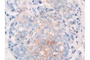 Immunohistochemistry (IHC) image for anti-Fibrillin 1 (FBN1) (AA 723-902) antibody (ABIN7438973)