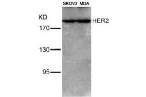 Image no. 3 for anti-Receptor tyrosine-protein kinase erbB-2 (ErbB2/Her2) (Tyr1221), (Tyr1222) antibody (ABIN197225) (ErbB2/Her2 antibody  (Tyr1221, Tyr1222))
