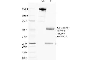 SDS-PAGE (SDS) image for anti-Cytochrome C, Somatic (CYCS) (AA 1-80) antibody (ABIN6940320)