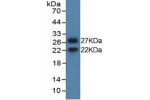 Western Blotting (WB) image for Interleukin 6 (IL6) ELISA Kit (ABIN6574135)