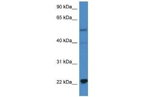 Western Blot showing IL18 antibody used at a concentration of 1 ug/ml against Hela Cell Lysate (IL-18 antibody  (C-Term))