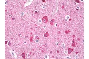 Anti-LC3 antibody IHC of human brain, cortex neurons. (MAP1LC3A antibody  (AA 1-50))