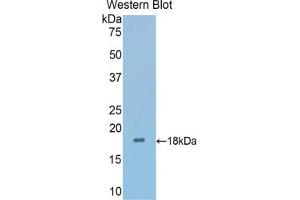 Western blot analysis of the recombinant protein. (SFRP4 antibody  (AA 27-154))