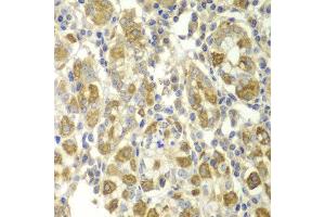 Immunohistochemistry (IHC) image for anti-Tumor Necrosis Factor alpha (TNF alpha) (AA 1-233) antibody (ABIN3020863) (TNF alpha antibody  (AA 1-233))