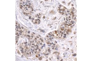 anti-Zinc Finger Protein 106 Homolog (ZFP106) (AA 1833-1883) antibody