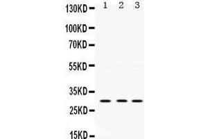 Western Blotting (WB) image for anti-Protein Kinase, AMP-Activated, beta 2 Non-Catalytic Subunit (PRKAB2) (AA 56-89), (N-Term) antibody (ABIN3043907) (PRKAB2 antibody  (N-Term))