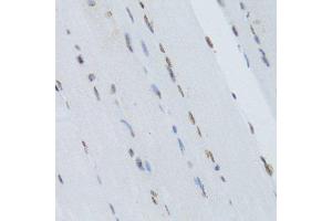 Immunohistochemistry (Paraffin-embedded Sections) (IHC (p)) image for anti-Nuclear Factor of kappa Light Polypeptide Gene Enhancer in B-Cells 2 (NFKB2) (AA 690-899) antibody (ABIN3017388)