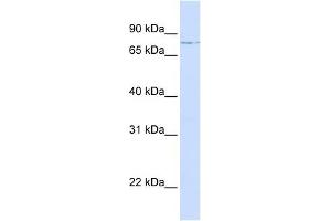 LCP1 antibody used at 1 ug/ml to detect target protein.