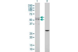 Western Blot analysis of LIPA expression in transfected 293T cell line by LIPA monoclonal antibody (M01), clone 1F9. (Lipase A antibody  (AA 1-399))