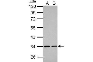 ETFA antibody  (Center)