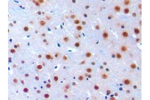 DAB staining on IHC-P; Samples: Mouse Cerebrum Tissue (IRF1 antibody  (AA 44-319))