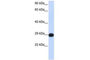 Image no. 1 for anti-Protein Phosphatase 4, Catalytic Subunit (PPP4C) (C-Term) antibody (ABIN6744282)