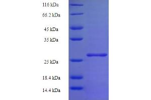 HIST1H2BD Protein (AA 2-126) (His-SUMO Tag)