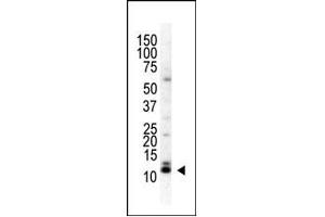Image no. 1 for anti-Small Ubiquitin Related Modifier 3 (SUMO3) (C-Term) antibody (ABIN356741) (SUMO3 antibody  (C-Term))