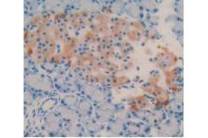 DAB staining on IHC-P; Samples: Rat Pancreas Tissue (Vitamin D-Binding Protein antibody  (AA 209-394))