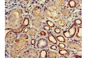 Immunohistochemistry of paraffin-embedded human kidney tissue using ABIN7145071 at dilution of 1:100 (COQ8B antibody  (AA 10-137))