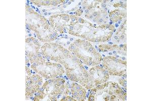 Immunohistochemistry of paraffin-embedded mouse kidney using TARS antibody (ABIN6132713, ABIN6148858, ABIN6148859 and ABIN6222758) at dilution of 1:100 (40x lens). (TARS antibody  (AA 1-230))