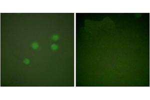 Immunofluorescence analysis of A549 cells, using Cyclin E1 antibody.