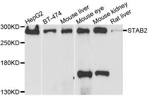 Western blot analysis of extracts of various cell lines, using STAB2 antibody. (Stabilin 2 (STAB2) (AA 1550-1850) antibody)