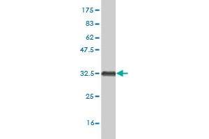 Western Blot detection against Immunogen (33 KDa) . (HOXB7 antibody  (AA 55-120))