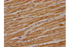 IHC image of ABIN7140227 diluted at 1:700 and staining in paraffin-embedded human heart tissue performed on a Leica BondTM system. (CACNG8 antibody  (AA 65-83))
