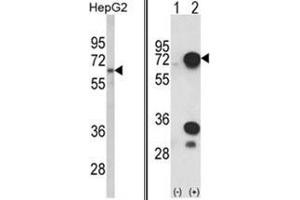 (LEFT) Western blot analysis of HNRPL Antibody (C-term) in HepG2 cell line lysates (35ug/lane). (HNRNPL antibody  (C-Term))