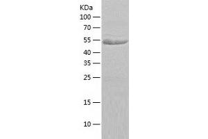 BAIAP2 Protein (AA 1-522) (His tag)