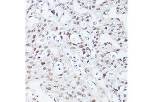 Immunohistochemistry of paraffin-embedded mouse fetal Heart using Islet1 Rabbit mAb (ABIN7268024) at dilution of 1:100 (40x lens). (ISL1 antibody)