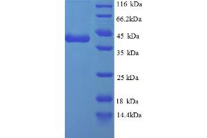 SDS-PAGE (SDS) image for Replication Protein A3, 14kDa (RPA3) (AA 1-119), (partial) protein (GST tag) (ABIN5713006)