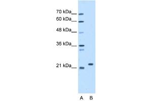 WB Suggested Anti-SDF2 Antibody Titration:  1. (SDF2 antibody  (N-Term))