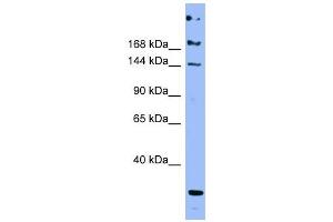 ApoB antibody used at 1 ug/ml to detect target protein. (APOB antibody  (Middle Region))