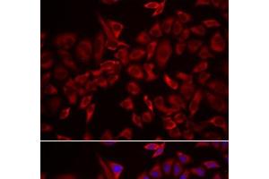 Immunofluorescence analysis of HeLa cells using CSRP3 Polyclonal Antibody (CSRP3 antibody)